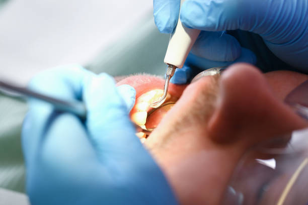 Best Broken or Cracked Tooth Emergency Dentist in South Browning, MT