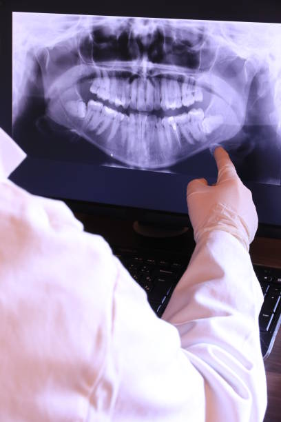 Best Emergency Dentist for Lost Fillings or Crowns in South Browning, MT